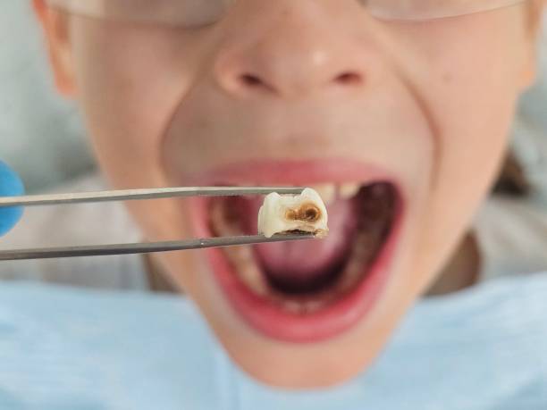 Best Emergency Dentist for Knocked-Out Tooth in La Grange Park, IL